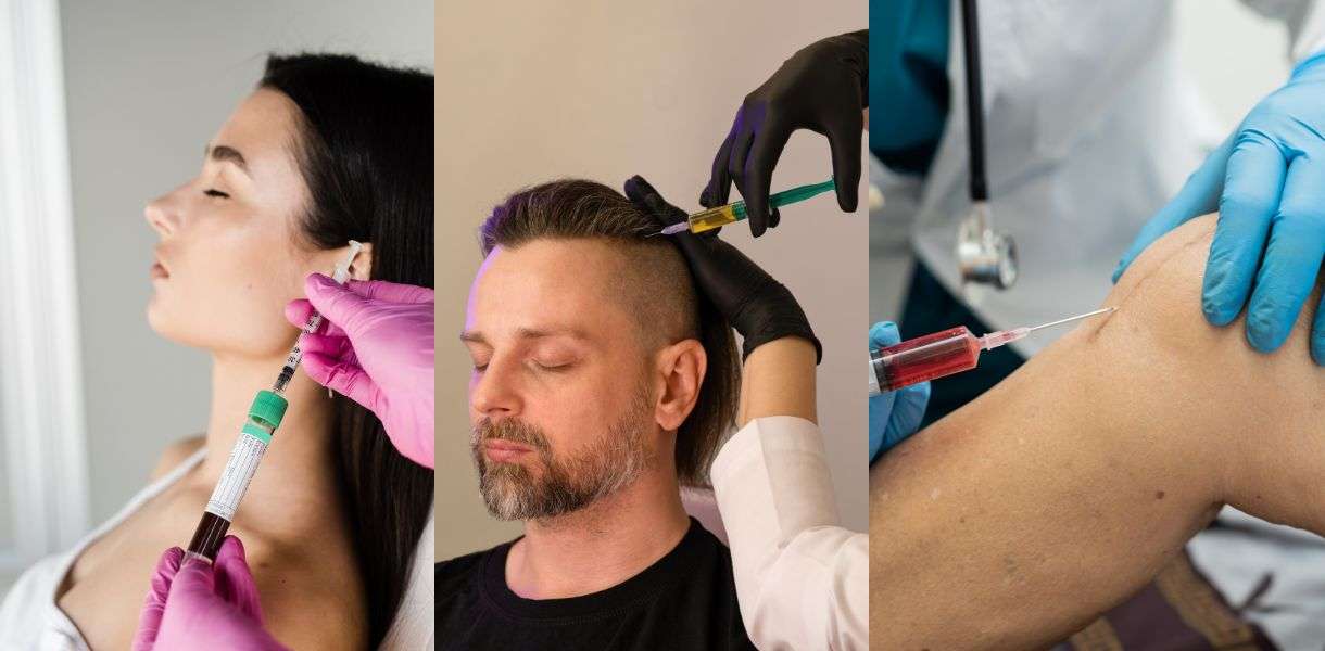 Platelet-Rich Plasma (PRP) Therapy